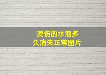 烫伤的水泡多久消失正常图片