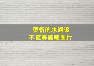 烫伤的水泡该不该弄破呢图片