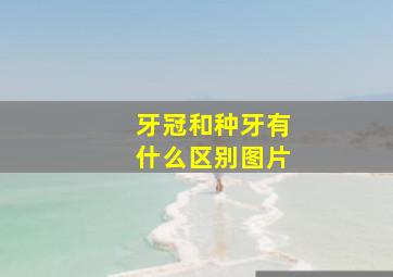 牙冠和种牙有什么区别图片