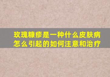 玫瑰糠疹是一种什么皮肤病怎么引起的如何注意和治疗