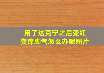 用了达克宁之后变红变痒脚气怎么办呢图片