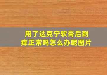 用了达克宁软膏后刺痒正常吗怎么办呢图片