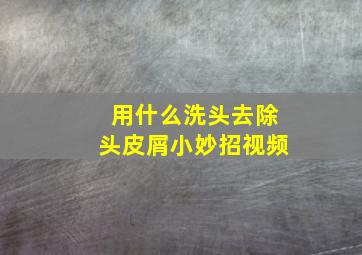 用什么洗头去除头皮屑小妙招视频