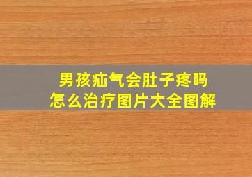 男孩疝气会肚子疼吗怎么治疗图片大全图解