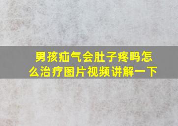 男孩疝气会肚子疼吗怎么治疗图片视频讲解一下