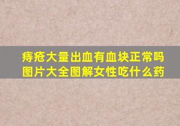 痔疮大量出血有血块正常吗图片大全图解女性吃什么药