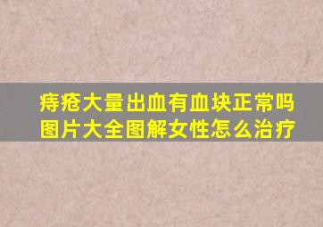 痔疮大量出血有血块正常吗图片大全图解女性怎么治疗