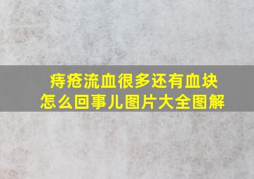 痔疮流血很多还有血块怎么回事儿图片大全图解