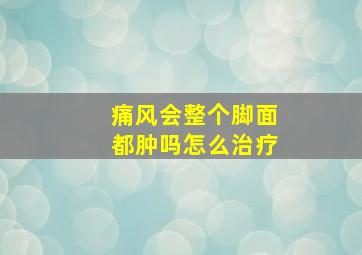 痛风会整个脚面都肿吗怎么治疗