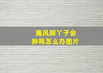 痛风脚丫子会肿吗怎么办图片