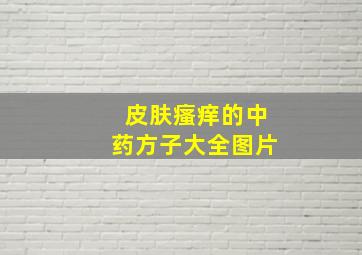 皮肤瘙痒的中药方子大全图片