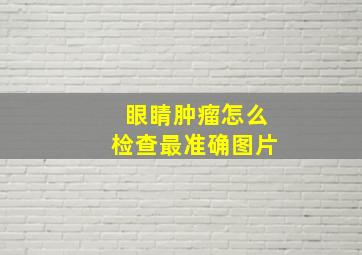 眼睛肿瘤怎么检查最准确图片