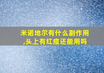 米诺地尔有什么副作用,头上有红痘还能用吗