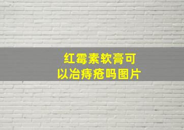 红霉素软膏可以冶痔疮吗图片