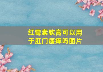 红霉素软膏可以用于肛门瘙痒吗图片