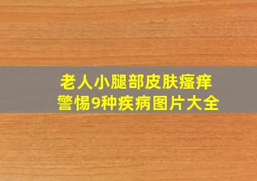 老人小腿部皮肤瘙痒警惕9种疾病图片大全