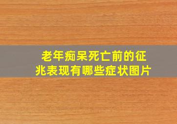 老年痴呆死亡前的征兆表现有哪些症状图片