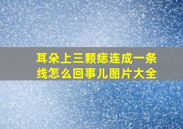 耳朵上三颗痣连成一条线怎么回事儿图片大全