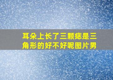 耳朵上长了三颗痣是三角形的好不好呢图片男