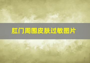 肛门周围皮肤过敏图片