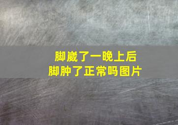 脚崴了一晚上后脚肿了正常吗图片