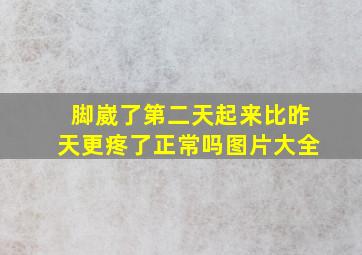 脚崴了第二天起来比昨天更疼了正常吗图片大全