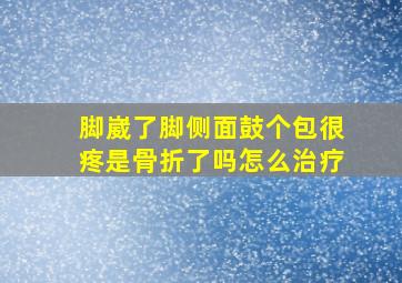 脚崴了脚侧面鼓个包很疼是骨折了吗怎么治疗