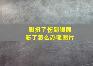 脚扭了伤到脚面筋了怎么办呢图片