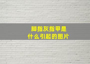 脚指灰指甲是什么引起的图片