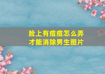 脸上有痘痘怎么弄才能消除男生图片