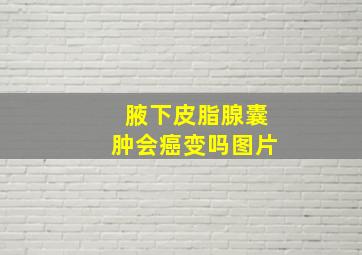 腋下皮脂腺囊肿会癌变吗图片