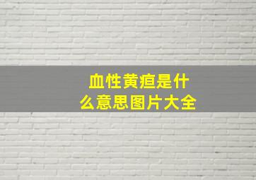 血性黄疸是什么意思图片大全