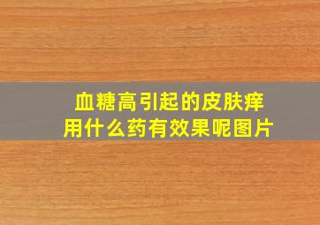 血糖高引起的皮肤痒用什么药有效果呢图片