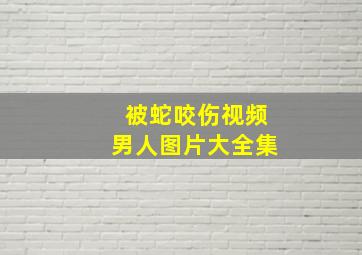 被蛇咬伤视频男人图片大全集