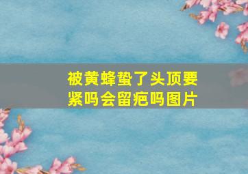 被黄蜂蛰了头顶要紧吗会留疤吗图片