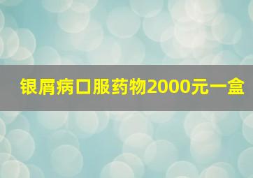 银屑病口服药物2000元一盒