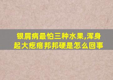 银屑病最怕三种水果,浑身起大疙瘩邦邦硬是怎么回事