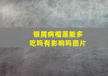 银屑病榴莲能多吃吗有影响吗图片