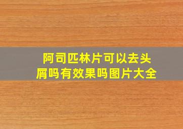 阿司匹林片可以去头屑吗有效果吗图片大全