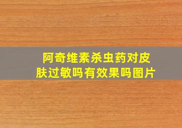 阿奇维素杀虫药对皮肤过敏吗有效果吗图片