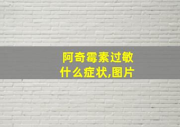 阿奇霉素过敏什么症状,图片