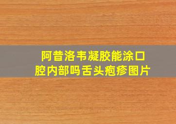 阿昔洛韦凝胶能涂口腔内部吗舌头疱疹图片