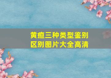 黄疸三种类型鉴别区别图片大全高清