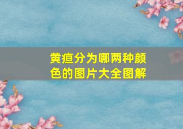 黄疸分为哪两种颜色的图片大全图解