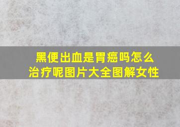 黑便出血是胃癌吗怎么治疗呢图片大全图解女性